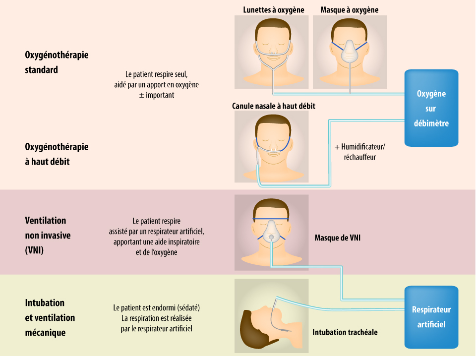 Les différentes méthodes d’oxygénothérapie